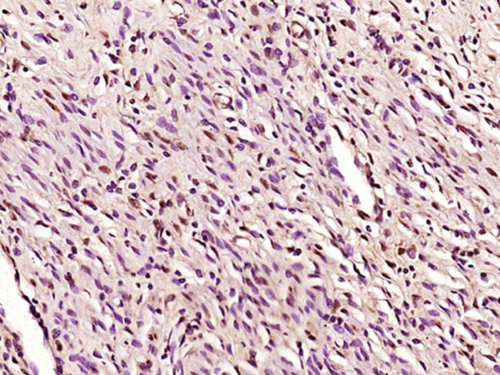 Anti-Phospho-Smad3 (Ser204) Polyclonal Antibody