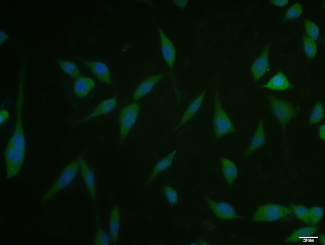 Anti-Phospho-mTOR (Ser2481) Polyclonal Antibody