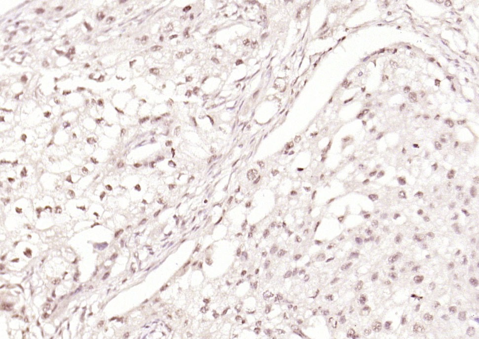 Anti-Phospho-Smad3 (Ser204) Polyclonal Antibody