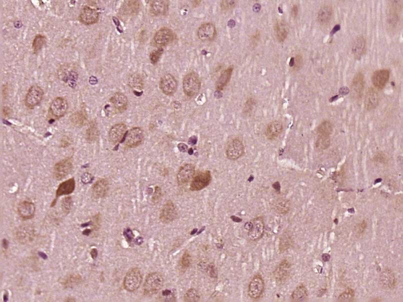 Anti-Phospho-MKK3/6 (Ser218, 207) Polyclonal Antibody