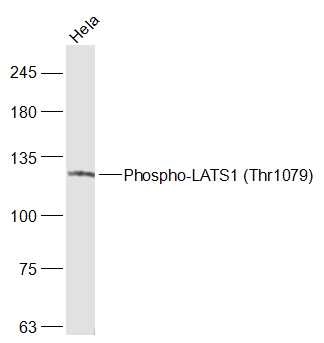 Anti-Phospho-LATS1 (Thr1079) Polyclonal Antibody
