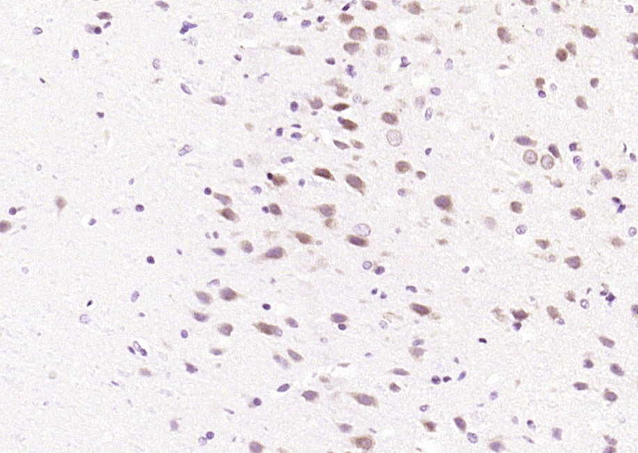 Anti-Phospho-JNK1/2/3 (Thr 183, Tyr185) Polyclonal Antibody