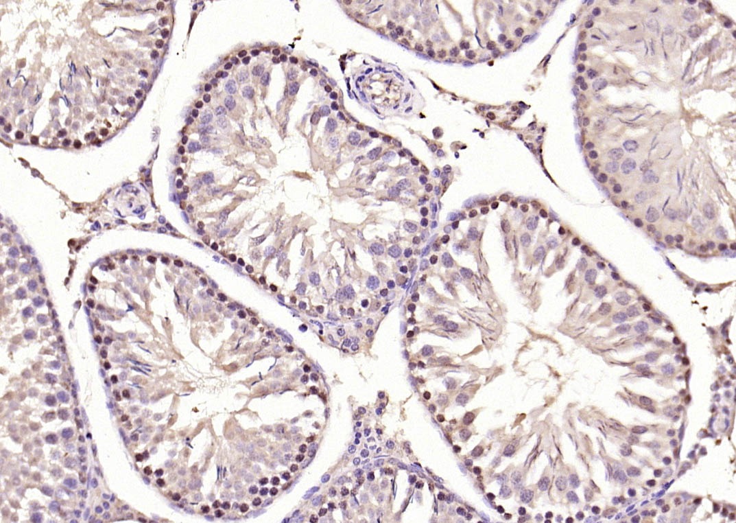 Anti-Phospho-Smad3 (Ser423, Ser425) Polyclonal Antibody