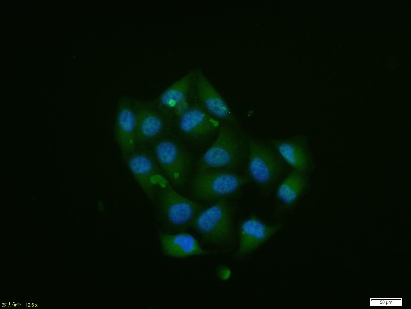 Anti-Phospho-Smad2 (Ser465, 467) Polyclonal Antibody