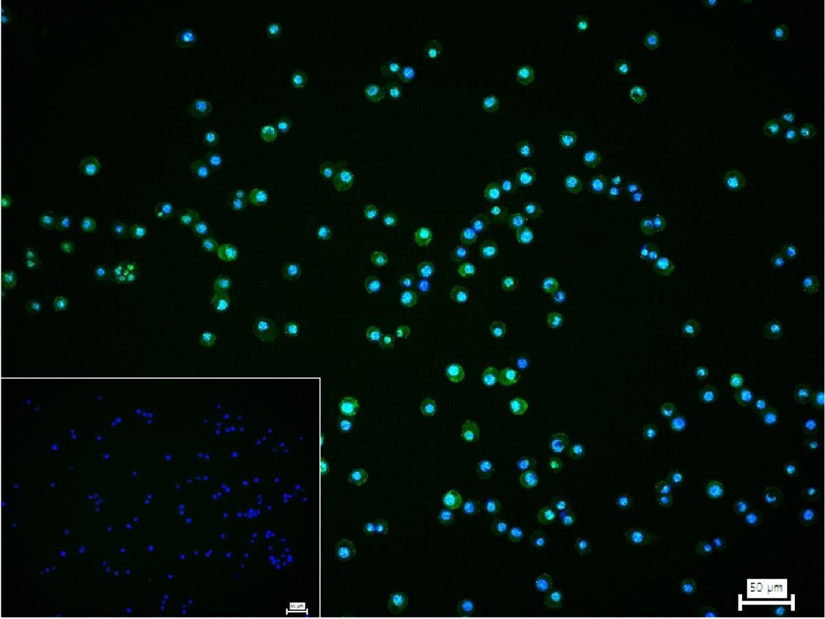 Anti-Phospho-MLKL (Ser345) Antibody (2S387)
