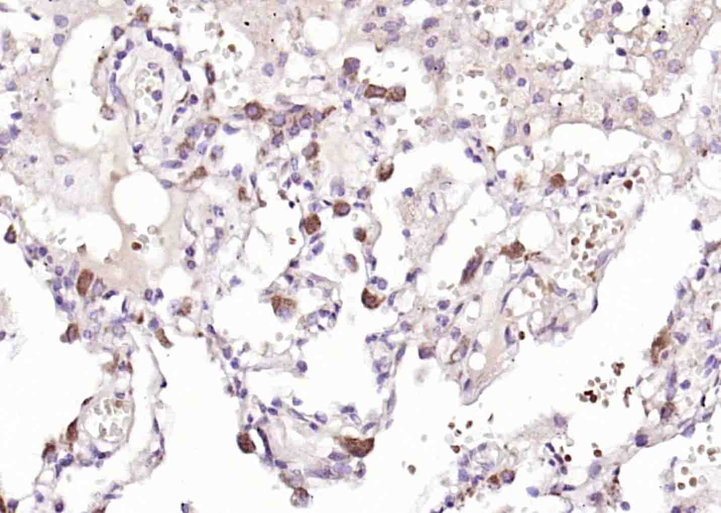 Anti-Phospho-MKK3/6 (Ser218, 207) Polyclonal Antibody