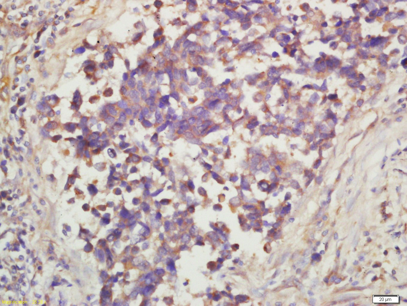 Anti-Phospho-mTOR (Ser2448) Polyclonal Antibody