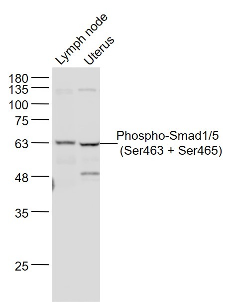 Anti-Phospho-Smad1/5 (Ser463, 465) Polyclonal Antibody