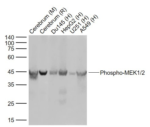 Anti-Phospho-MEK1/2 (Ser218, Ser222) Antibody (7E636)