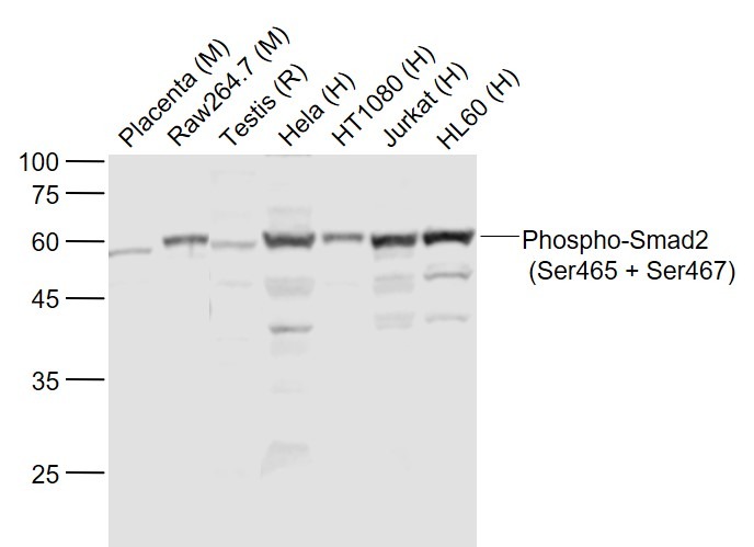 Anti-Phospho-Smad2 (Ser465, 467) Polyclonal Antibody