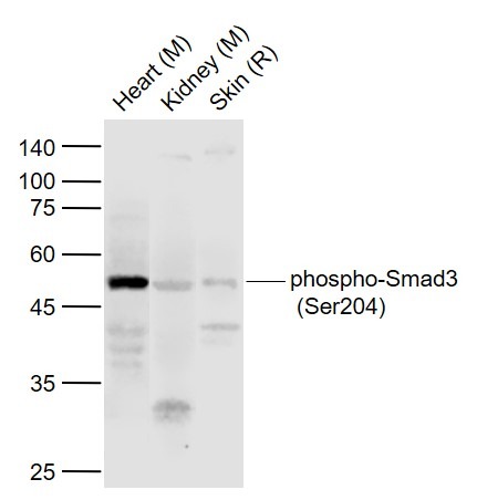 Anti-Phospho-Smad3 (Ser204) Polyclonal Antibody