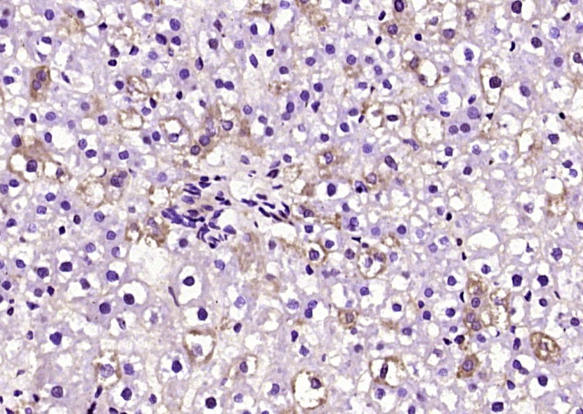 Anti-Phospho-LATS1 (Ser909) Polyclonal Antibody