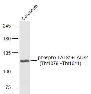 Anti-Phospho-LATS1/2 (Thr1079, 1041) Polyclonal Antibody