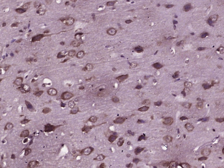 Anti-Phospho-JNK1/2/3 (Thr 183, Tyr185) Polyclonal Antibody