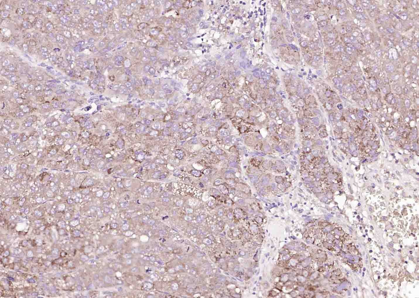 Anti-Phospho-MKK3/6 (Ser218, 207) Polyclonal Antibody