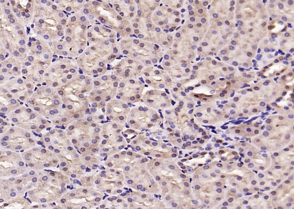 Anti-Phospho-Smad3 (Ser423, Ser425) Polyclonal Antibody