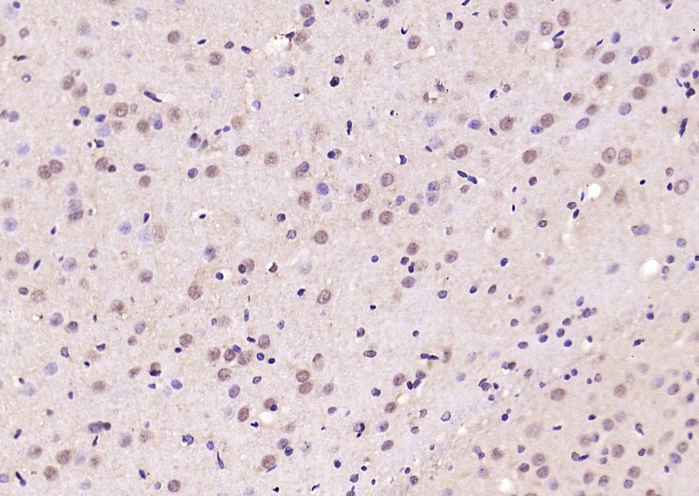 Anti-Phospho-Smad3 (Thr179) Polyclonal Antibody