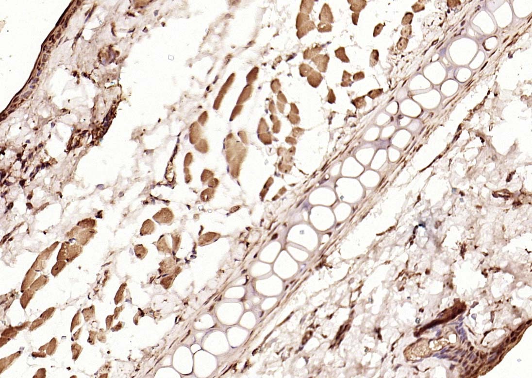 Anti-Phospho-Smad3 (Thr179) Polyclonal Antibody