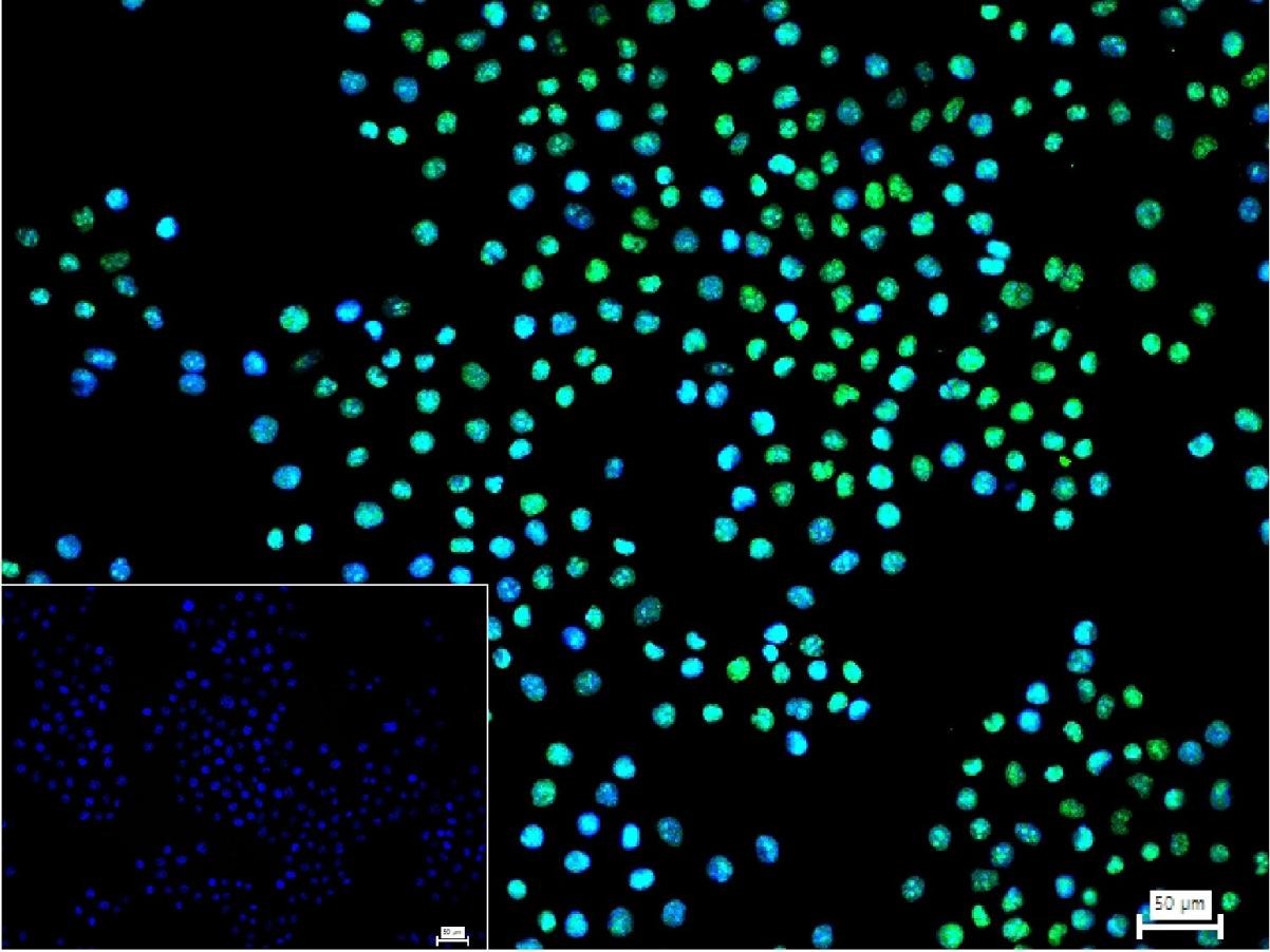 Anti-Phospho-NFE2L2 (Ser40) Antibody (8Z908)