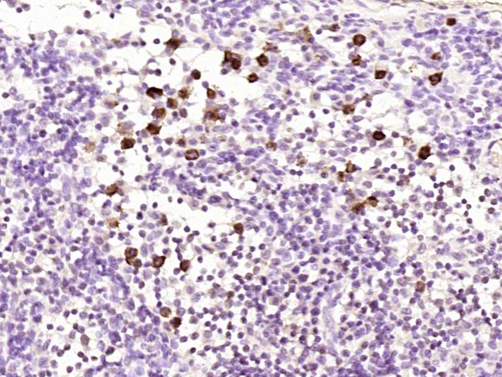 Anti-Phospho-NF-kB p65 (Ser468) Polyclonal Antibody