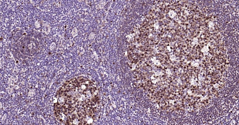 Anti-Phospho-NFE2L2 (Ser40) Antibody (8Z908)