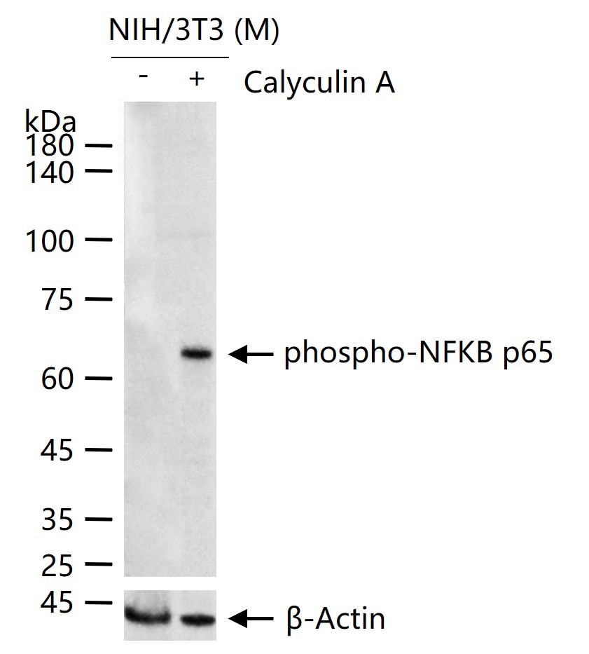 Anti-Phospho-NF-kB p65 (Ser536) Polyclonal Antibody