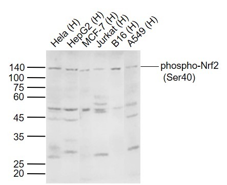 Anti-Phospho-NFE2L2 (Ser40) Polyclonal Antibody