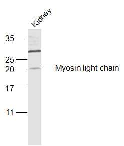 Anti-Phospho-MYL9 (Ser20) Polyclonal Antibody