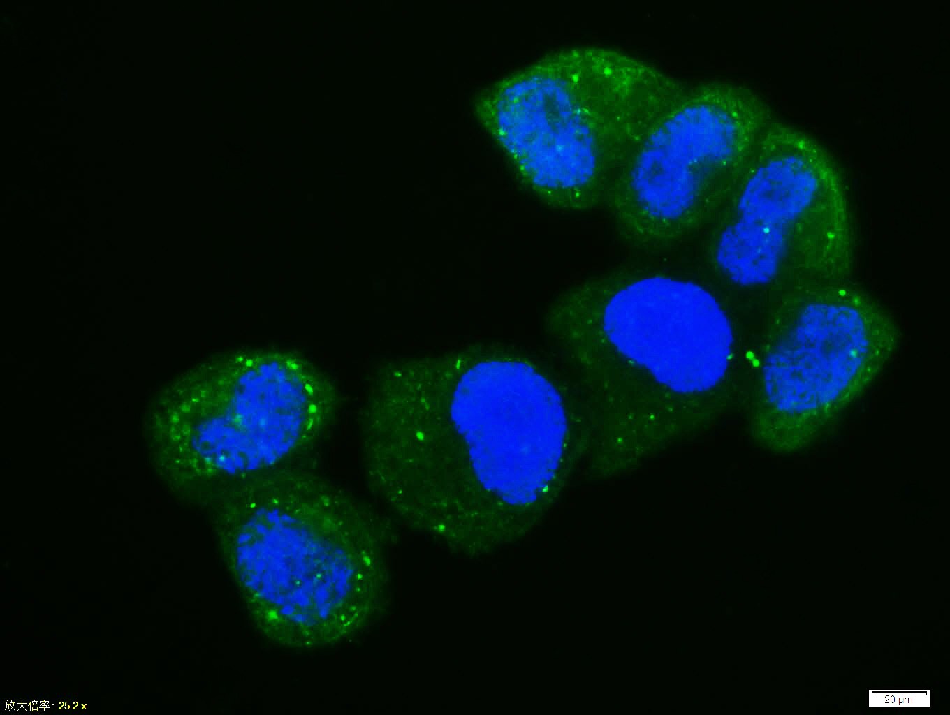 Anti-Phospho-NF-kB p65 (Ser468) Polyclonal Antibody