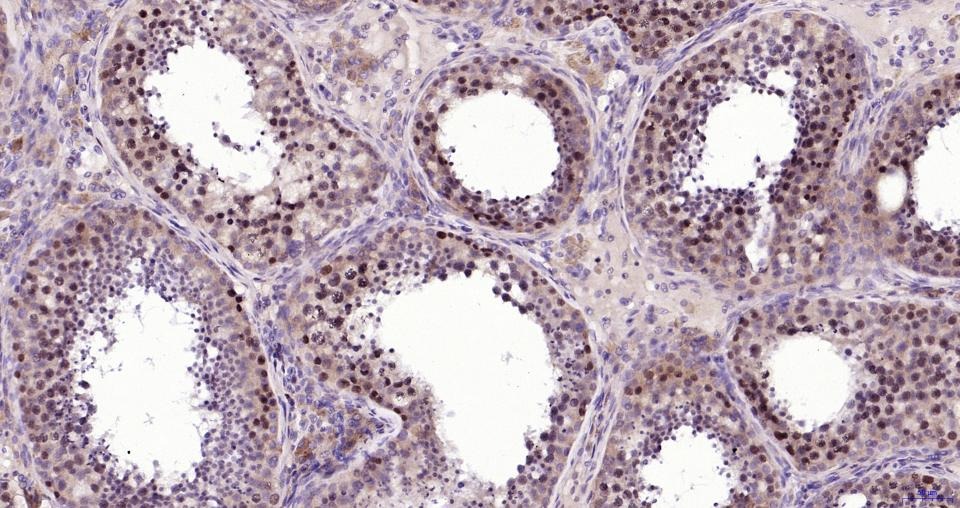 Anti-Phospho-NFE2L2 (Ser40) Antibody (8Z908)