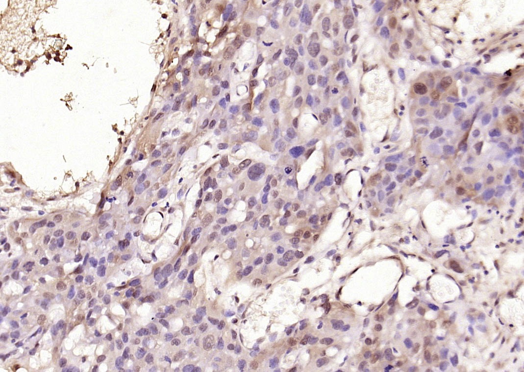 Anti-Phospho-Smad3 (Thr179) Polyclonal Antibody