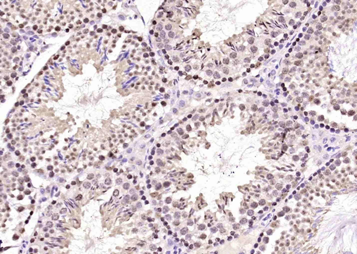 Anti-NEK7 Polyclonal Antibody