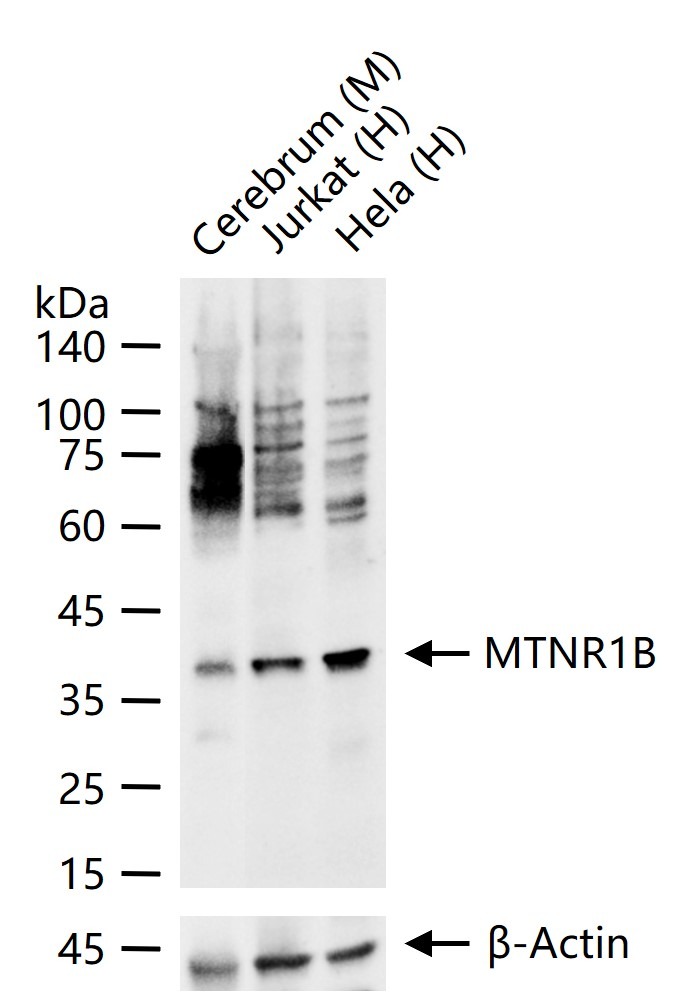 Anti-MTNR1B Polyclonal Antibody