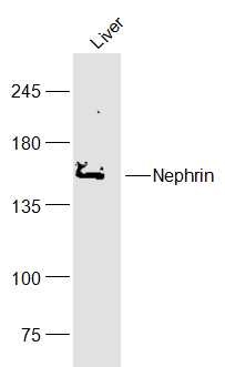 Anti-Nephrin Polyclonal Antibody