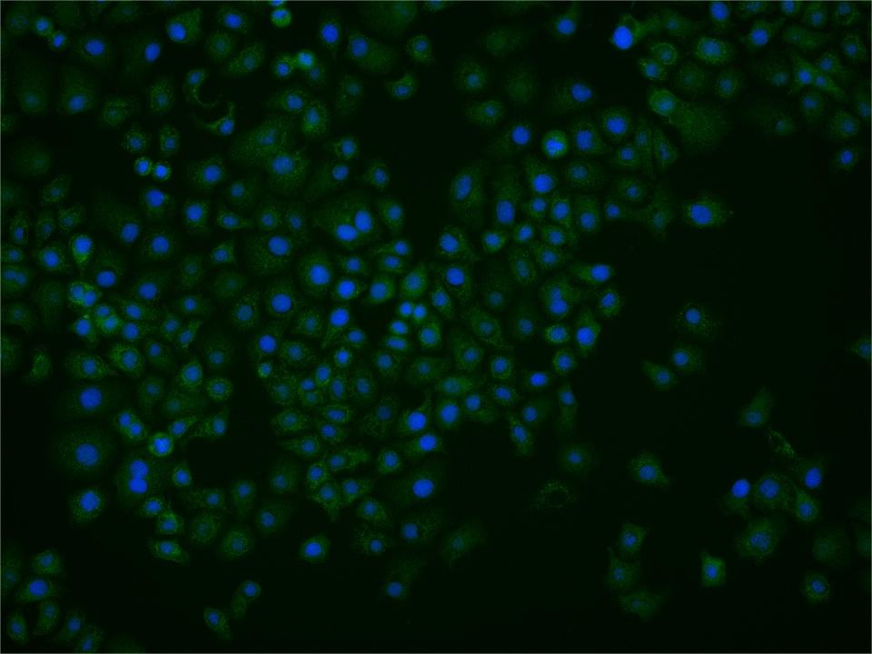 Anti-NET1 Polyclonal Antibody