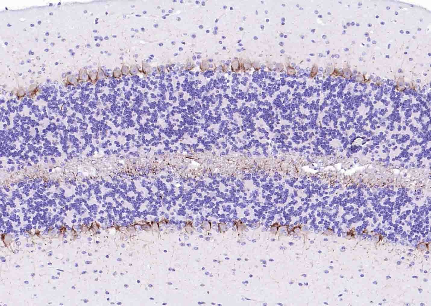 Anti-NEFH Polyclonal Antibody