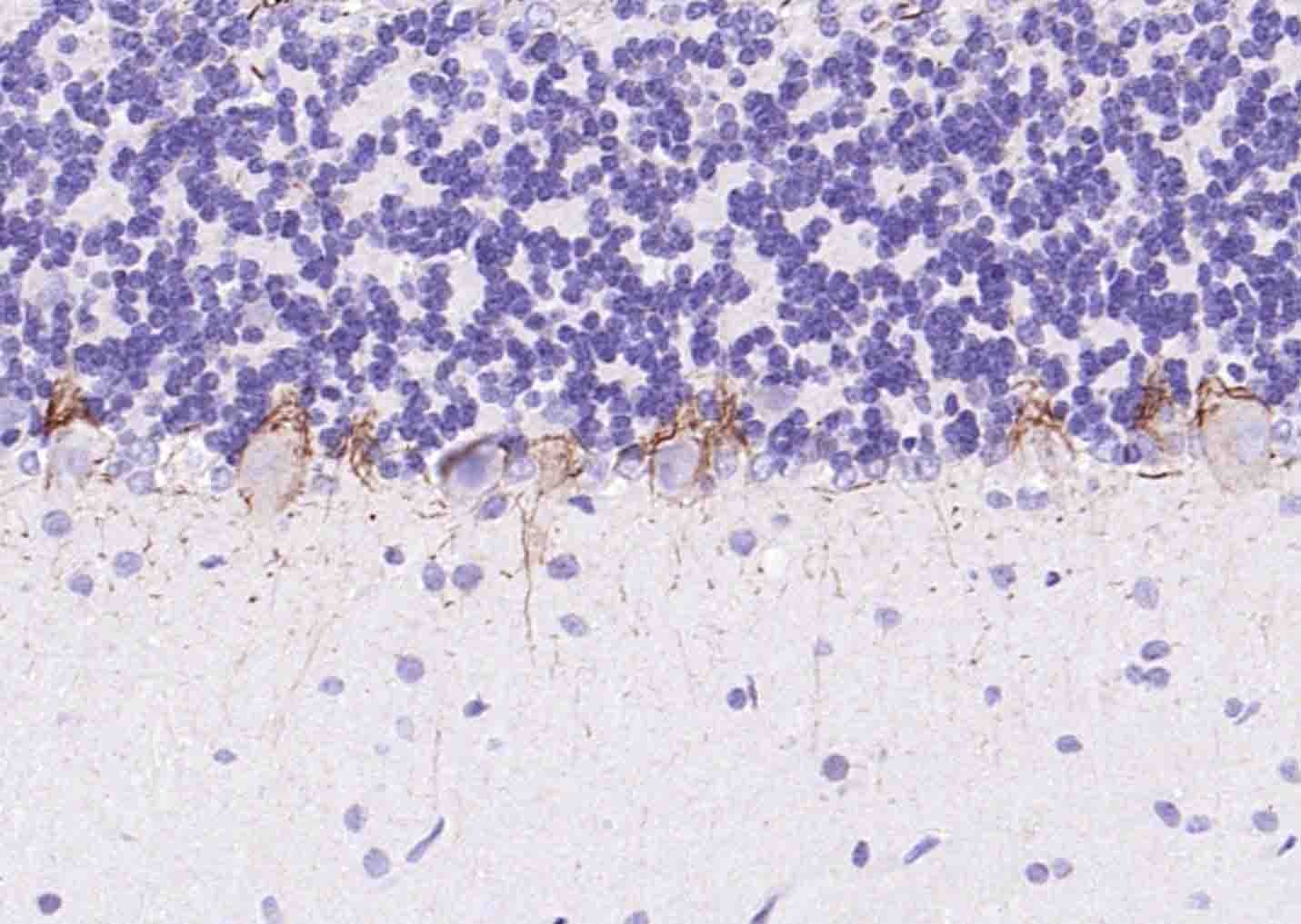 Anti-NEFH Polyclonal Antibody