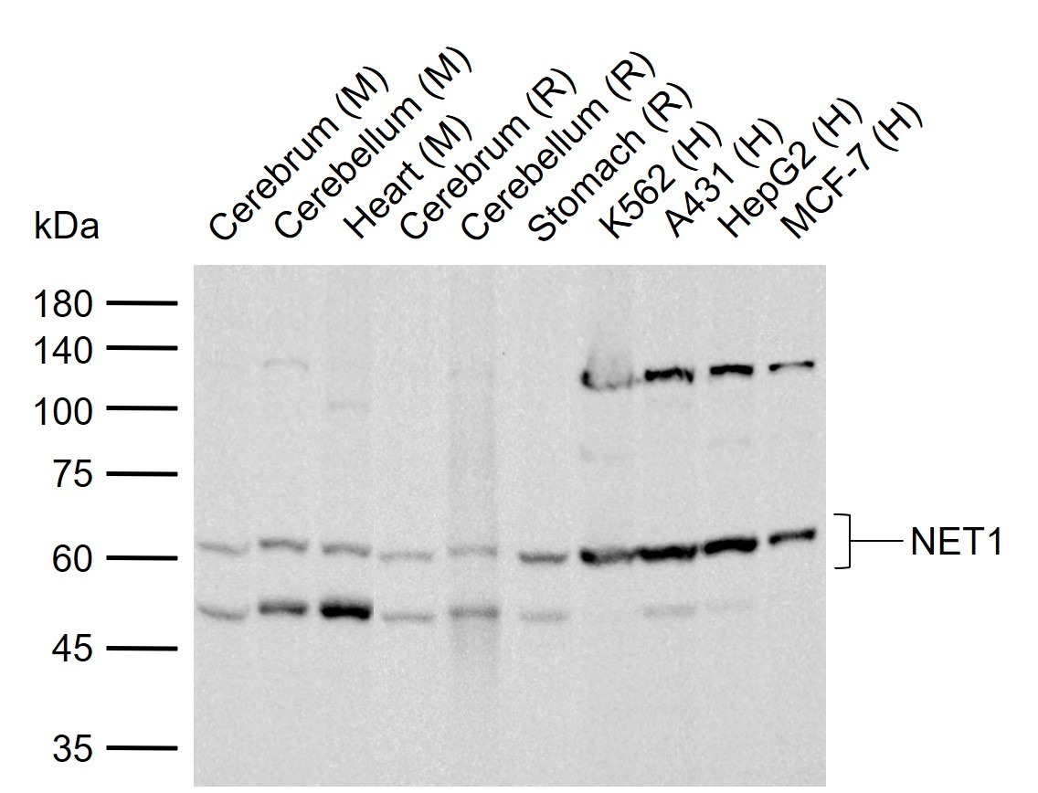 Anti-NET1 Polyclonal Antibody