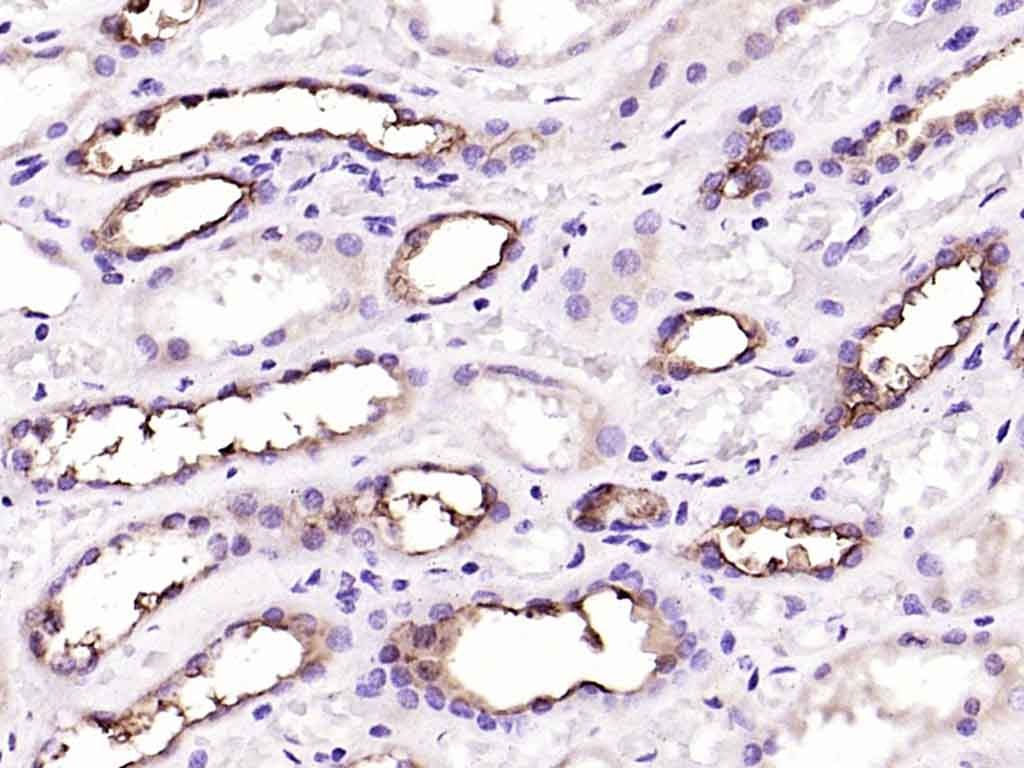 Anti-Mucin-1/MUC1 Polyclonal Antibody