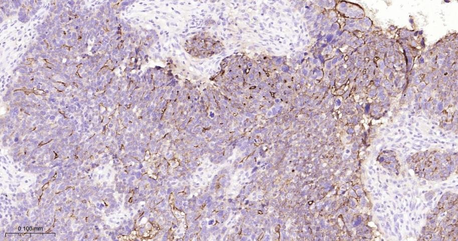 Anti-Mucin-16/MUC16 Antibody (8O689)