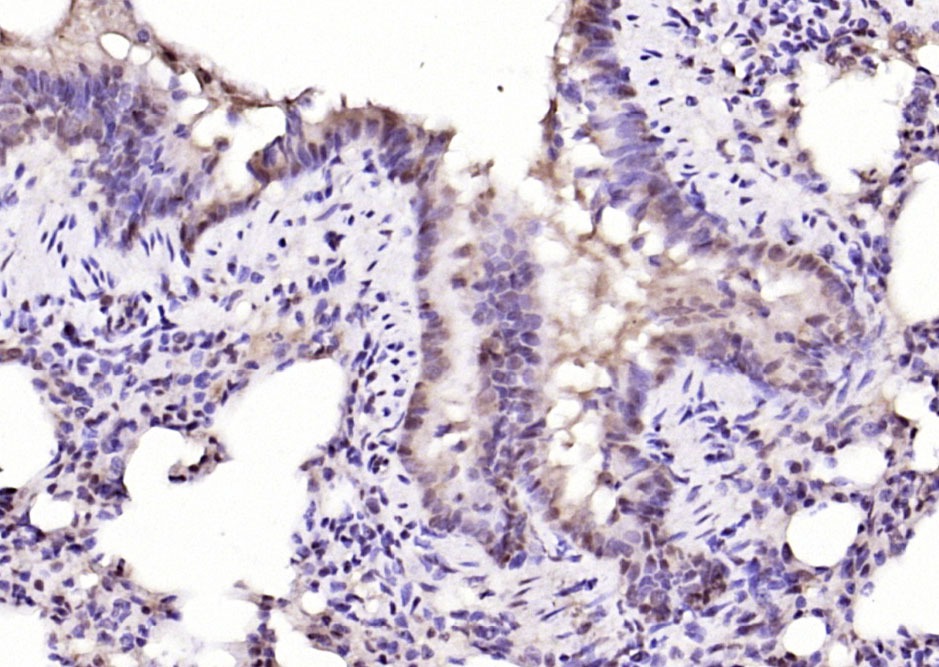 Anti-NFATC4 Polyclonal Antibody