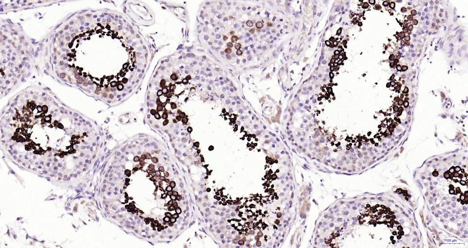 Anti-NFE2L2 Polyclonal Antibody