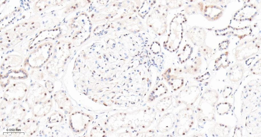 Anti-mTOR Antibody (2K378)