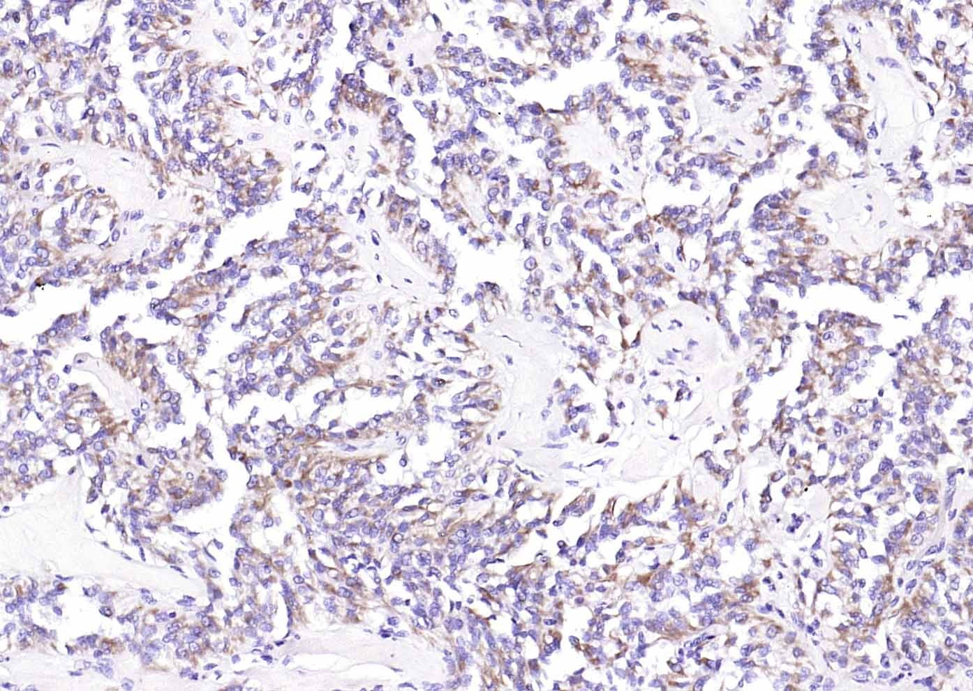 Anti-MUC5AC Polyclonal Antibody