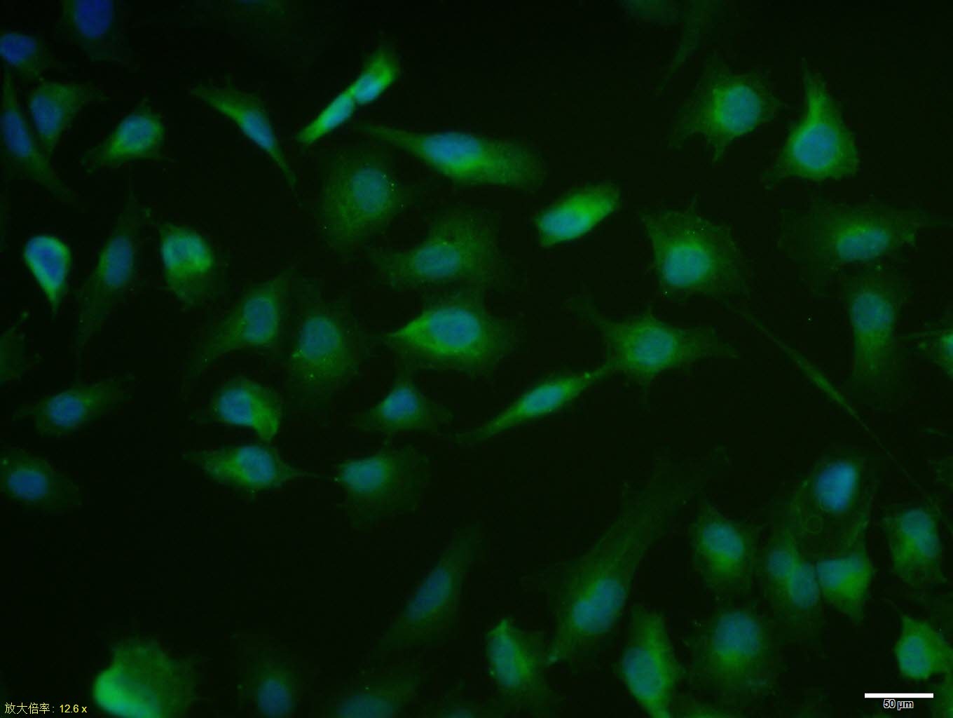 Anti-Mucin-1/MUC1 Polyclonal Antibody