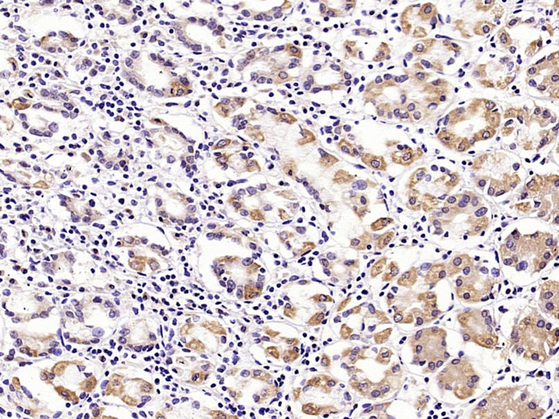 Anti-MUC5AC Polyclonal Antibody
