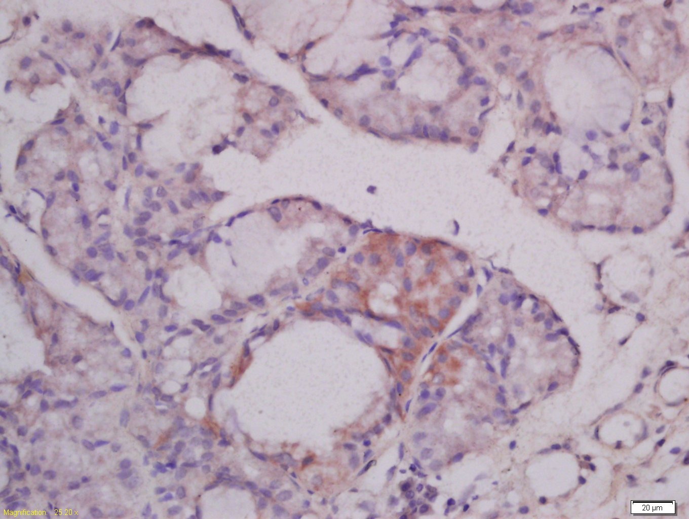 Anti-Mucin-4/MUC4 Polyclonal Antibody