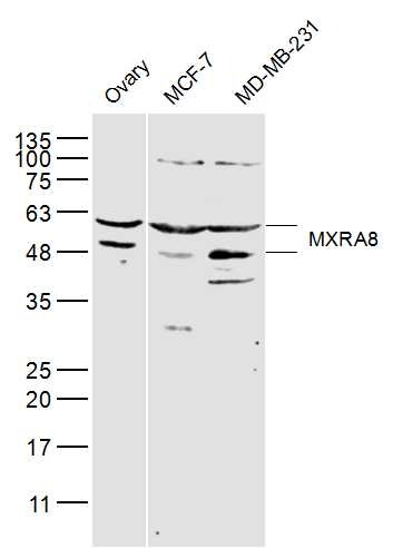 Anti-MXRA8 Polyclonal Antibody