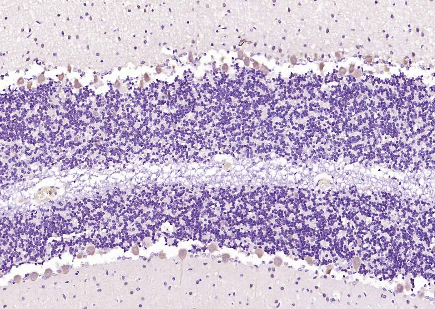 Anti-MXRA8 Polyclonal Antibody