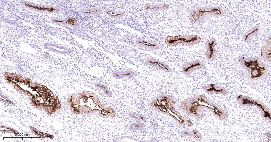 Anti-Mucin-16/MUC16 Antibody (8O689)